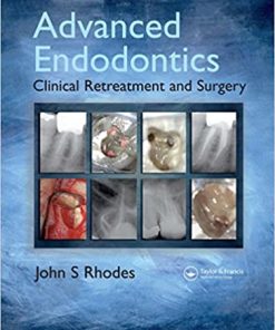 Advanced Endodontics Clinical Retreatment and Surgery