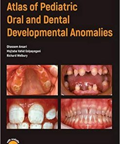 Atlas of Pediatric Oral And Dental Developmental Anomalies