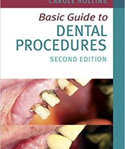 Basic Guide To Dental Procedures 2nd Edition