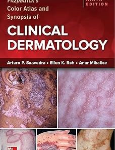 Fitzpatrick's Color Atlas and Synopsis of Clinical Dermatology, Ninth Edition
