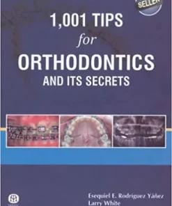1001 Tips for Orthodontics and its Secrets