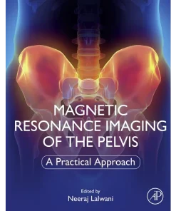 Magnetic Resonance Imaging of The Pelvis A Practical Approach