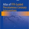 Atlas of FFR Guided Percutaneous Coronary Interventions