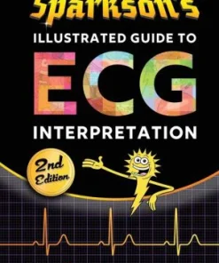Sparkson's Illustrated Guide to ECG Interpretation 2nd Edition