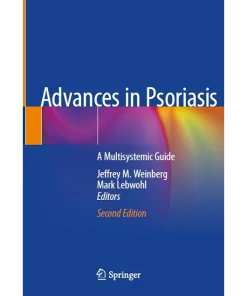 Advances in Psoriasis