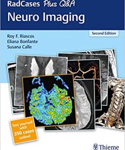 RadCases Plus Q&A Neuro Imaging 2nd Ed