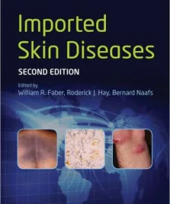 Imported Skin Diseases 2nd Edition