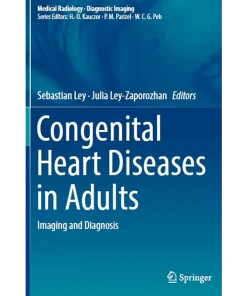 Congenital Heart Diseases in Adults Imaging and Diagnosis