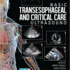 Basic Transesophageal and Critical Care Ultrasound