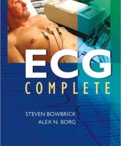 ECG Complete
