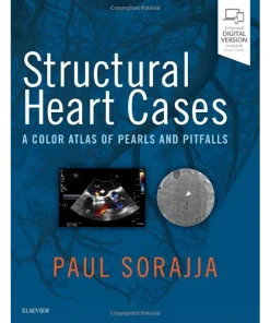 Structural Heart Cases A Color Atlas of Pearls and Pitfalls