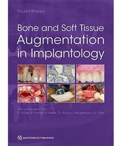 Bone and Soft Tissue Augmentation in Implantology