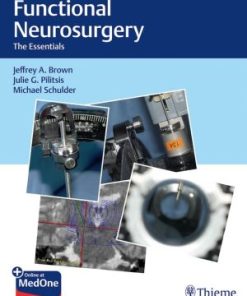 Functional Neurosurgery The Essentials