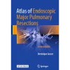 Atlas of Endoscopic Major Pulmonary Resections