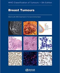Breast Tumours WHO Classification of Tumours 5th Edition