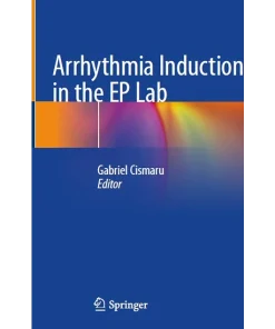 Arrhythmia Induction in the Ep Lab