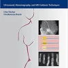 Interventional Breast Imaging Ultrasound Mammography and MR Guidance Techniques