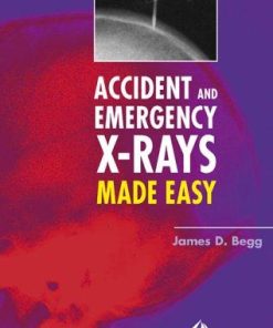 Accident and Emergency X rays Made Easy