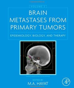 Brain Metastases from Primary Tumors Volume 2 Epidemiology Biology and Therapy