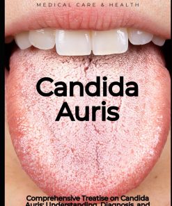 Comprehensive Treatise on Candida Auris Understanding Diagnosis and Treatment Medical care and health