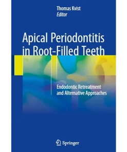 Springer Apical Periodontitis in Root-Filled Teeth