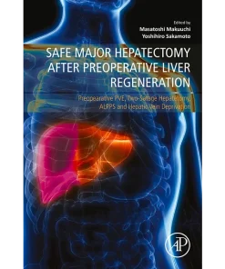 Safe Major Hepatectomy After Preoperative Liver Regeneration