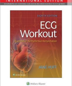 ECG Workout Exercises in Arrhythmia Interpretation 8th Edition