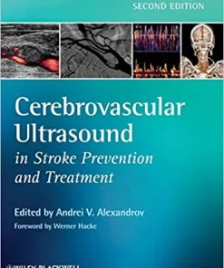 Cerebrovascular Ultrasound in Stroke Prevention and Treatment 2nd Edition