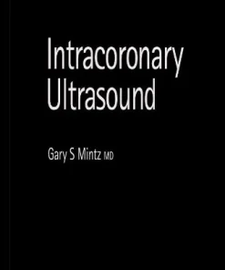 Intracoronary Ultrasound