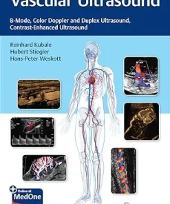 Vascular Ultrasound B Mode Color Doppler and Duplex Ultrasound Contrast-Enhanced Ultrasound
