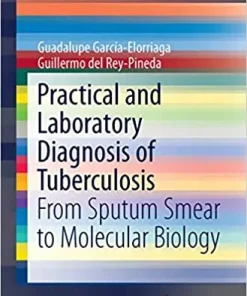 Practical and Laboratory Diagnosis of Tuberculosis From Sputum Smear to Molecular Biology