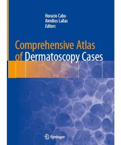 Comprehensive Atlas of Dermatoscopy Cases