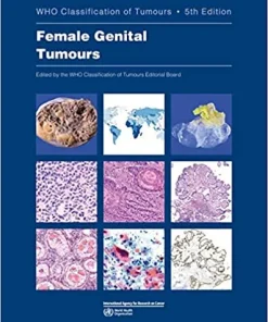WHO Classification of Tumours Female Genital Tumours 5th Edition