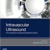 Intravascular Ultrasound From Acquisition to Advanced Quantitative Analysis