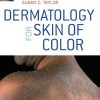 Dermatology for Skin of Color