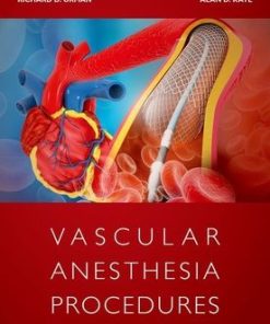 Vascular AneVascular Anesthesia Proceduressthesia Procedures