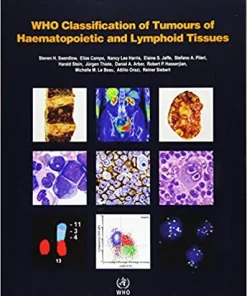 WHO Classification of Tumours of Haematopoietic and Lymphoid Tissues 4th Edition