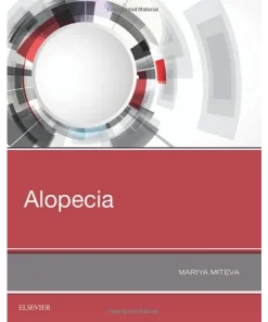 Elsevier Alopecia