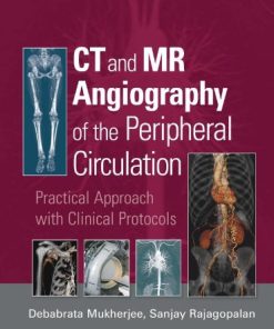 CT and MR Angiography of the Peripheral Circulation Practical Approach with Clinical Protocols