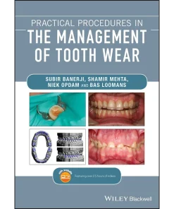 Practical Procedures in the Management of Tooth Wear