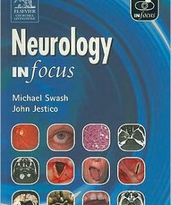 Neurology In Focus