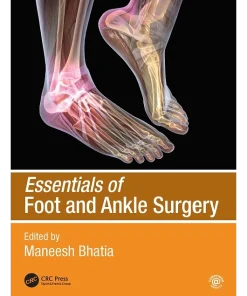 Essentials of Foot and Ankle Surgery