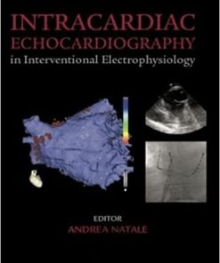 Kaplans Cardiac Anesthesia The Echo Era 6th Ed