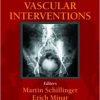 Complications in Peripheral Vascular Interventions
