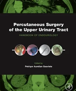 Percutaneous Surgery of the Upper Urinary Tract Handbook of Endourology