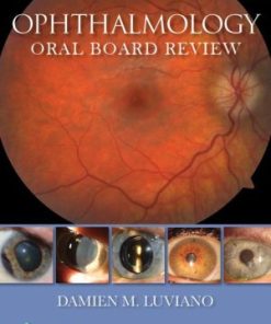 Ophthalmology Oral Board Review