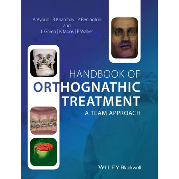 Handbook of Orthognathic Treatment