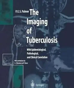 The Imaging of Tuberculosis With Epidemiological Pathological and Clinical Correlation