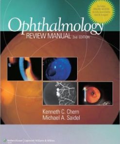 Ophthalmology Review Manual 2nd Edition