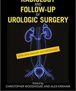 Radiology and Follow Up of Urologic Surgery